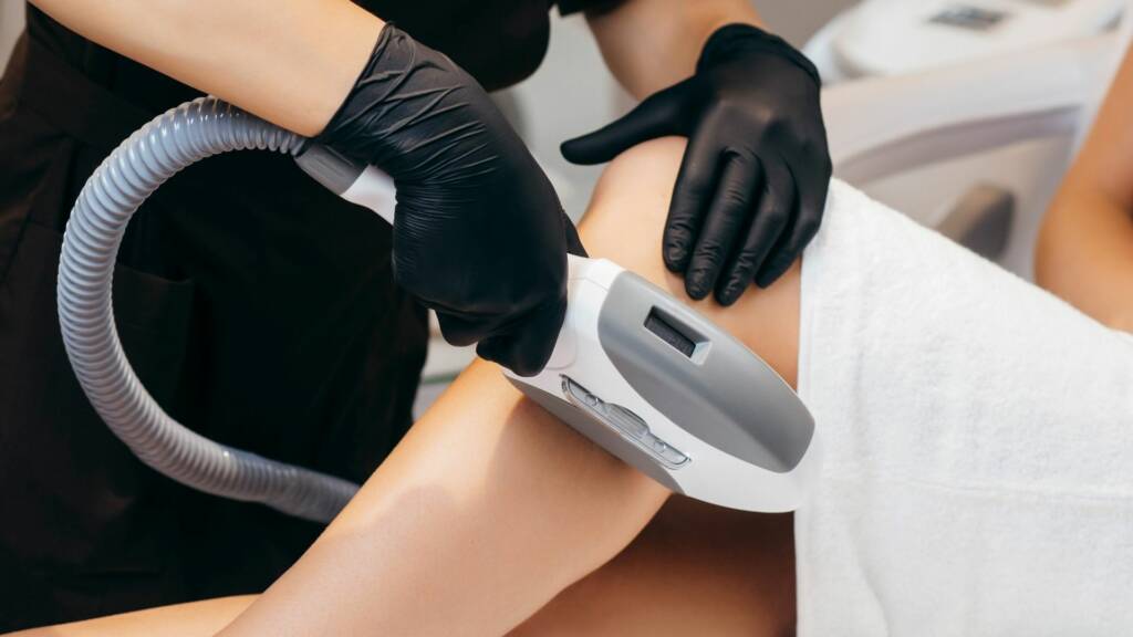 Warrington laser hair removal